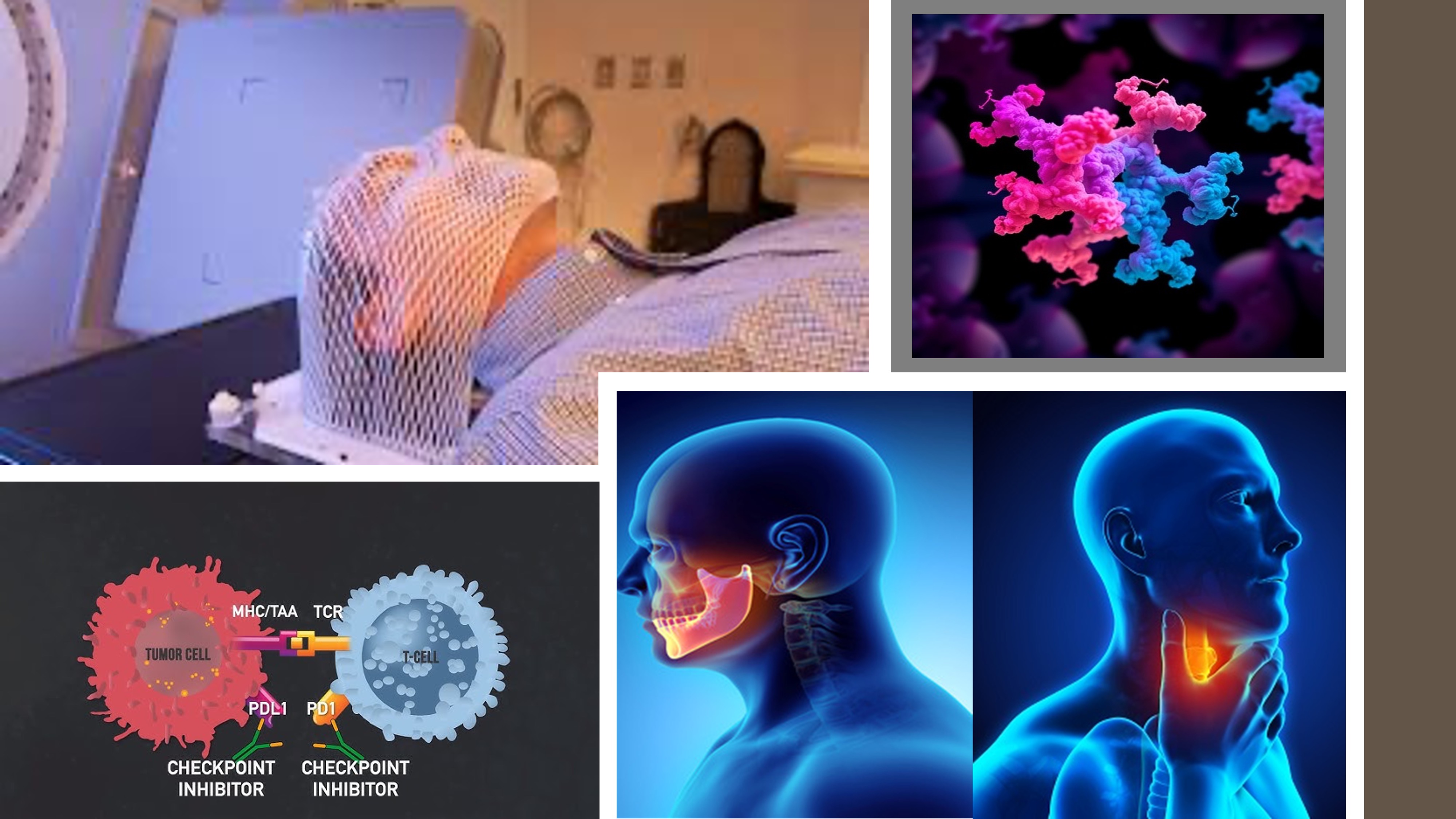 HanchorBio-Reports-Head-and-Neck-Cancer-Data-for-HCB101